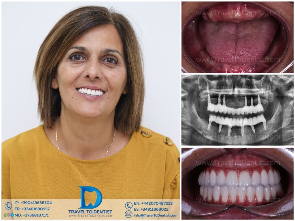 Caso clínico dental 5